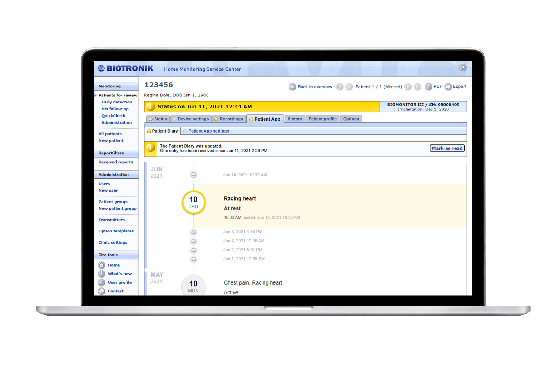 BIOTRONIK Home Monitoring Biotronik